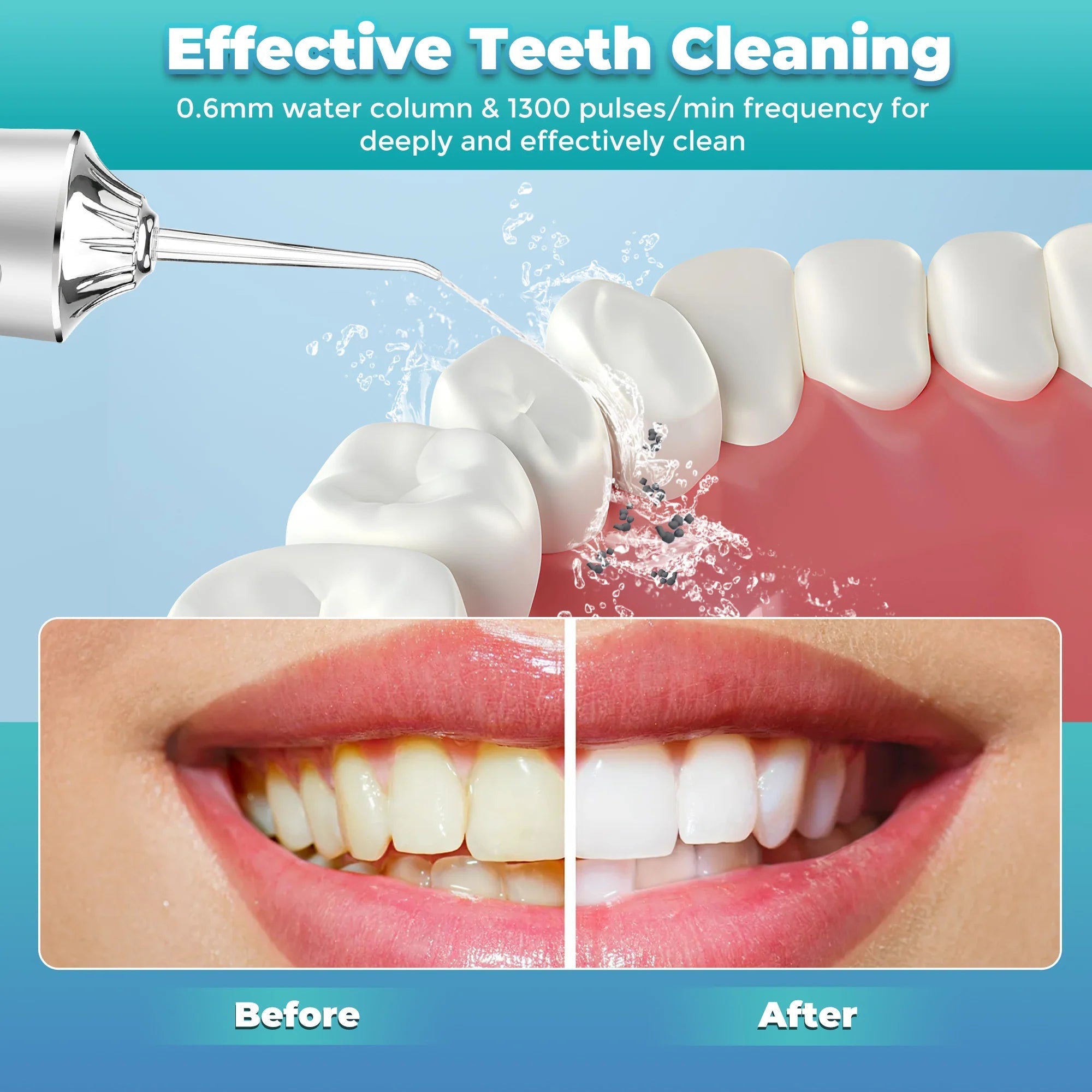 Cordless Oral Irrigator – 4 Tips