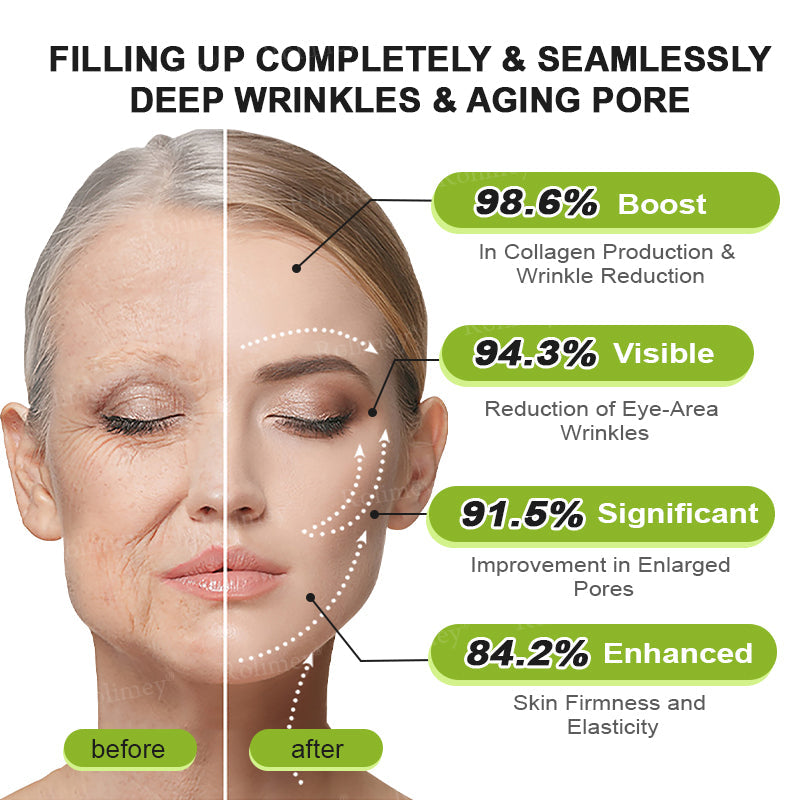 💫👨‍⚕️Made and shipped from the UK 💫Rolimey® Botox & Vita-A Retinol Shot Wrinkle-Lift Tightening cream - Last Day Promotion 70% OFF