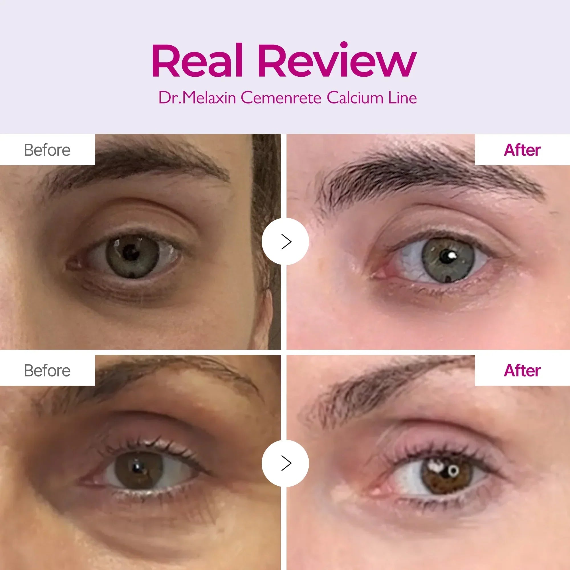 Korean Calcium Dark Spot Eye Cream