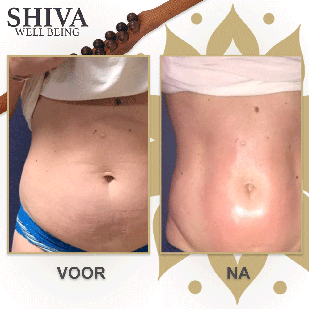 Gua Sha Wooden Therapy Staaf