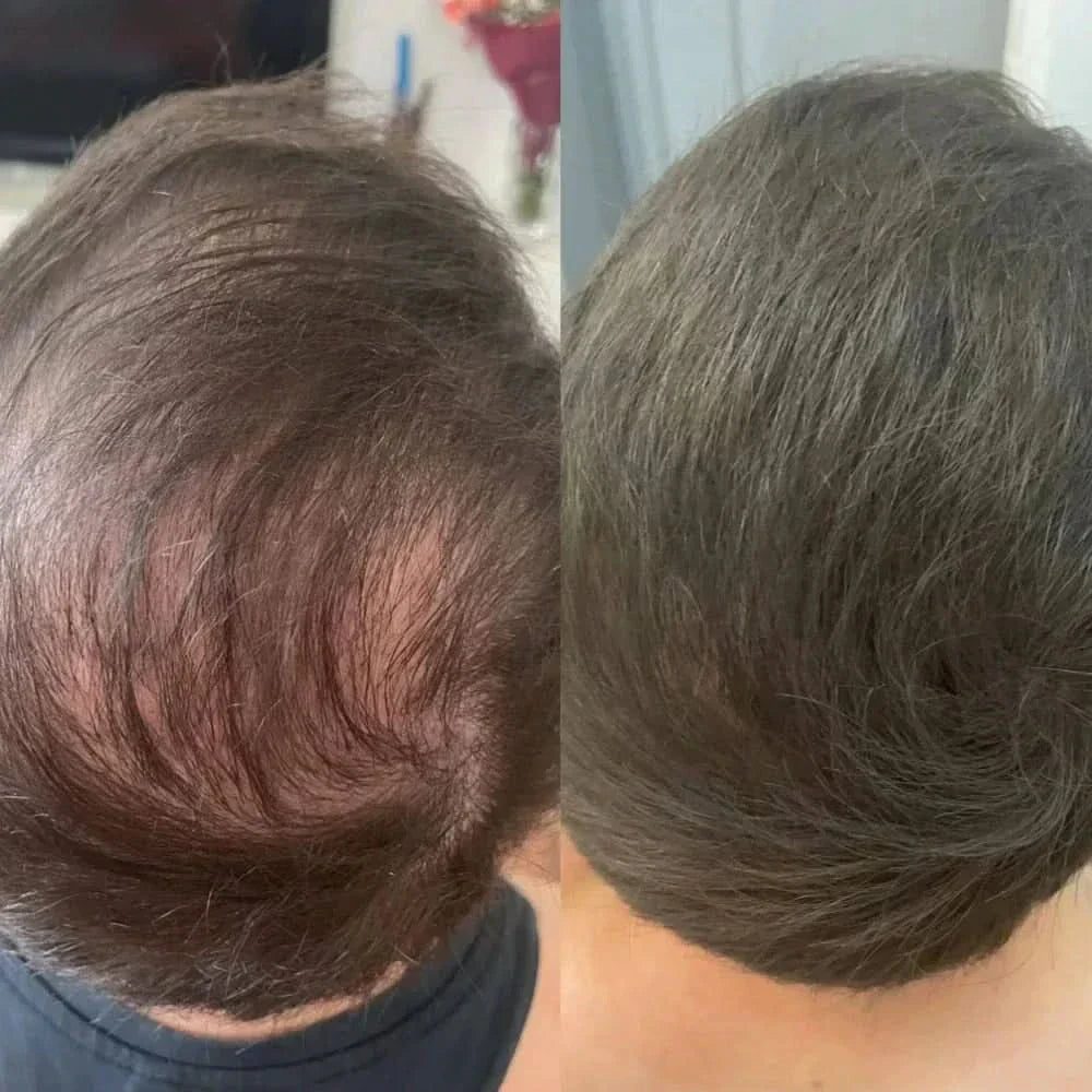 Hairline filler powder, a magical tool for shaping and filling the forehead, waterproof and sweatproof.