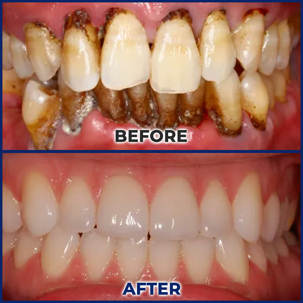 🥇BeeTakt Bee Venom Dental Treatment Drops Mouthwash