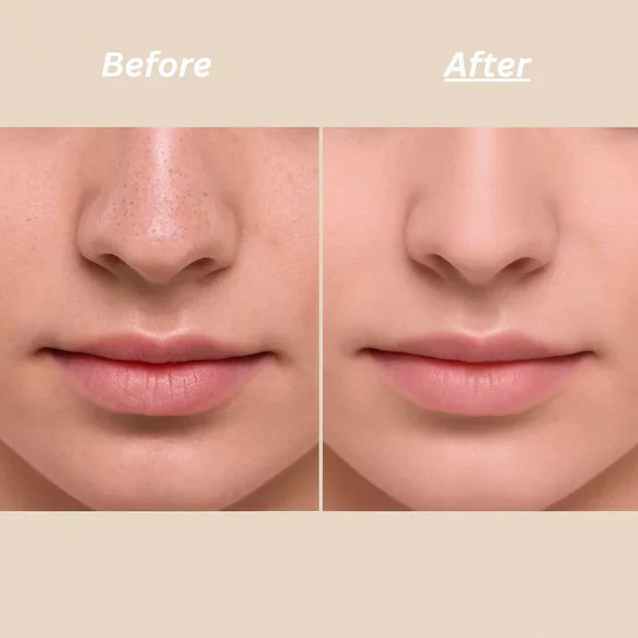 Dr Melaxin Peel Shot Ampoule