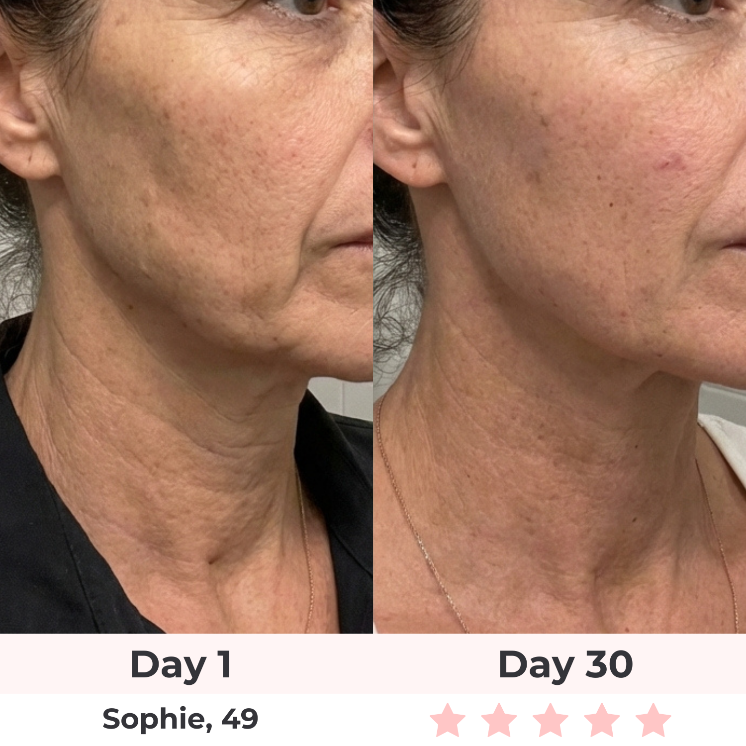 7-in-1 LED Facial Sculptor