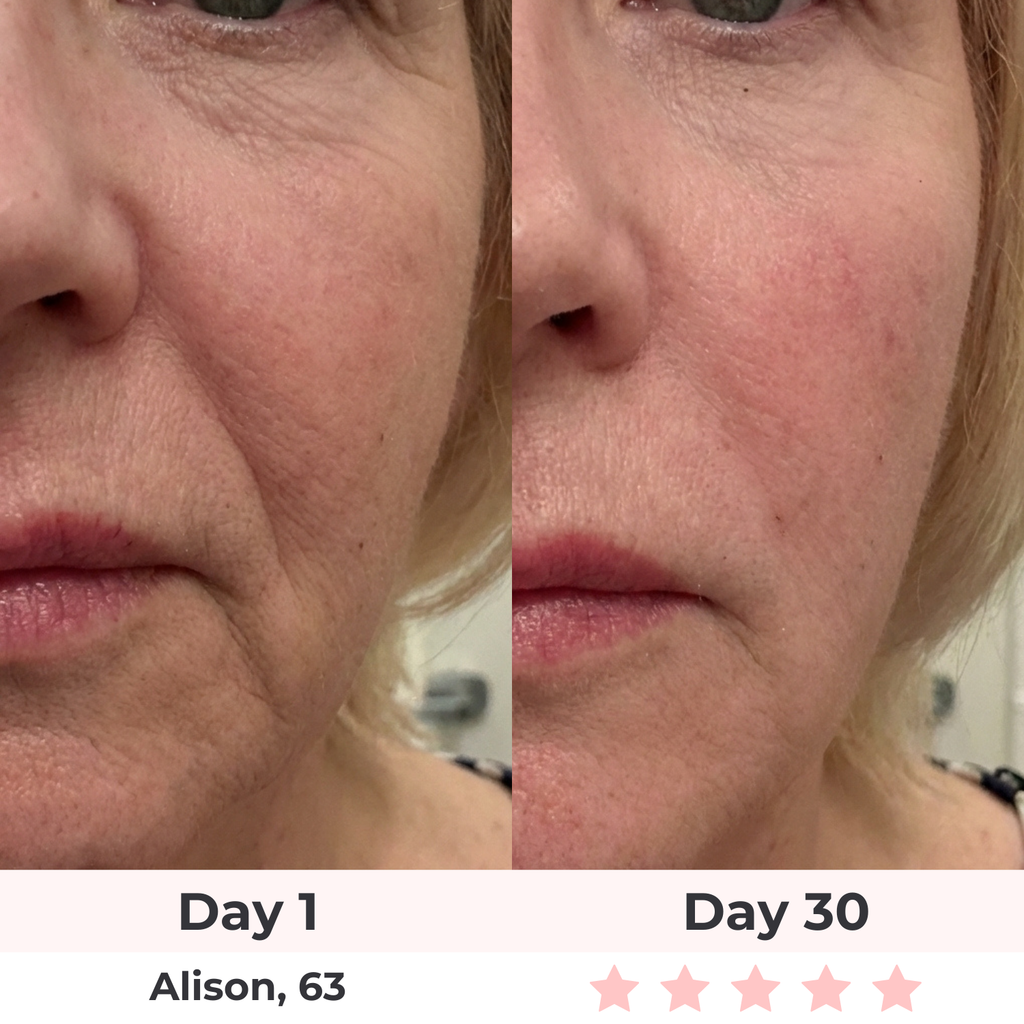 7-in-1 LED Facial Sculptor