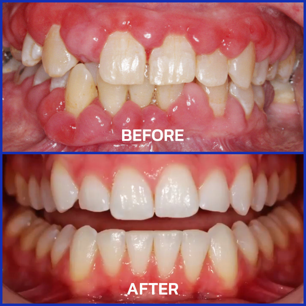 VioCore Bee Venom Dental Treatment Toothpaste