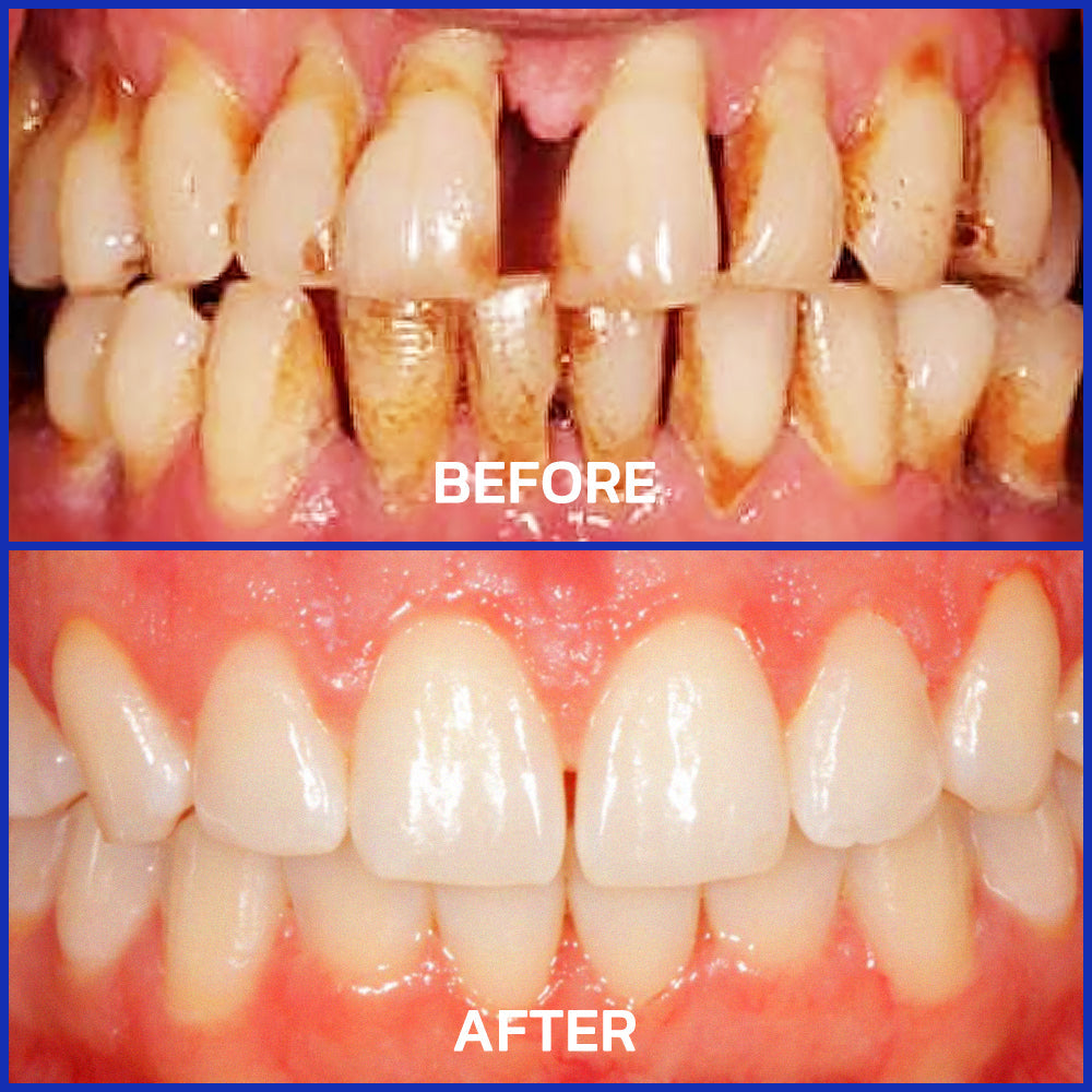 VioCore Bee Venom Dental Treatment Toothpaste