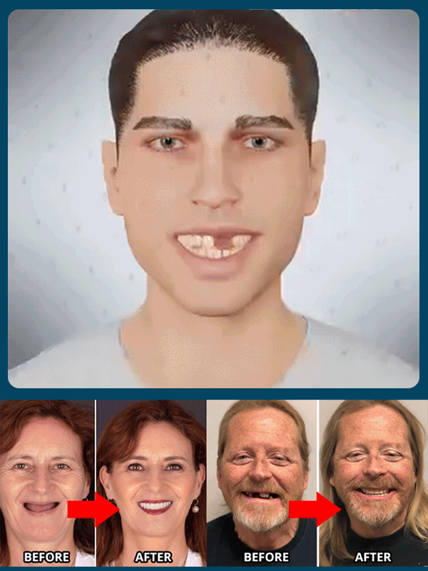 🔥【Finally! Dentures That Let You Eat Apples & Nuts】Perfect Smile Dentures