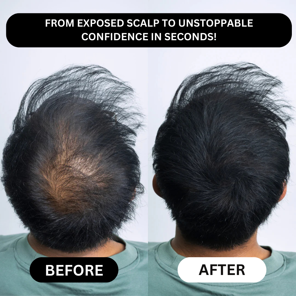 Hairline filler powder, a magical tool for shaping and filling the forehead, waterproof and sweatproof.